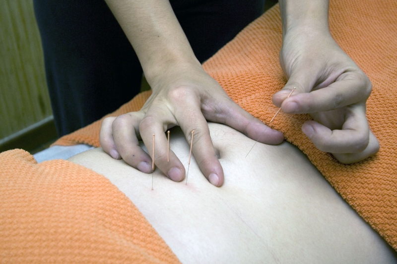 osteopathe-GRASSE-min_acupuncture-4175625